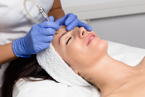 Microdermabrasion Facial- Osage Beach