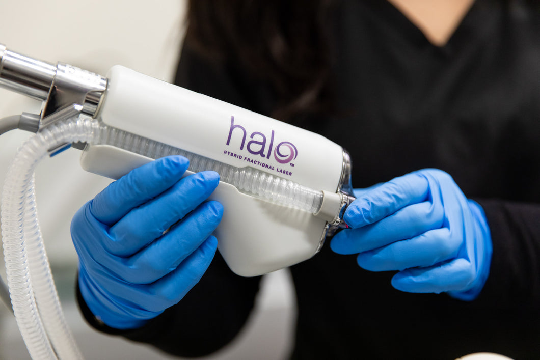 Halo by Sciton- Full Face | Neck | Chest Treatment- Osage Beach