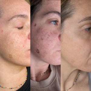 Photofacial Series of 3- Osage Beach Office