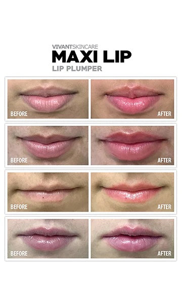 Vivant Maxi Lip Balm