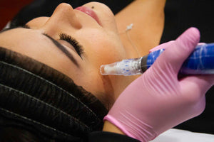 Microneedling- Osage Beach